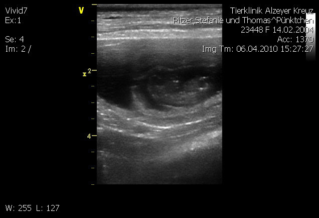 erstes Ultraschallbild