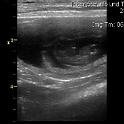 Previous image